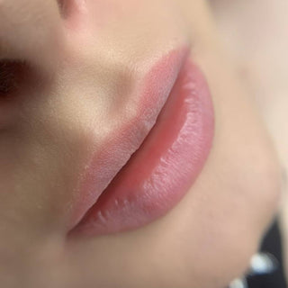 Face Amsterdam Healed
