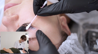 Chemical tattoo Removal Etalon Mix